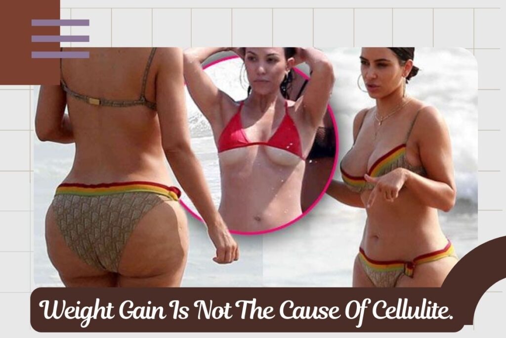 Weight Gain Is Not The Cause Of Cellulite