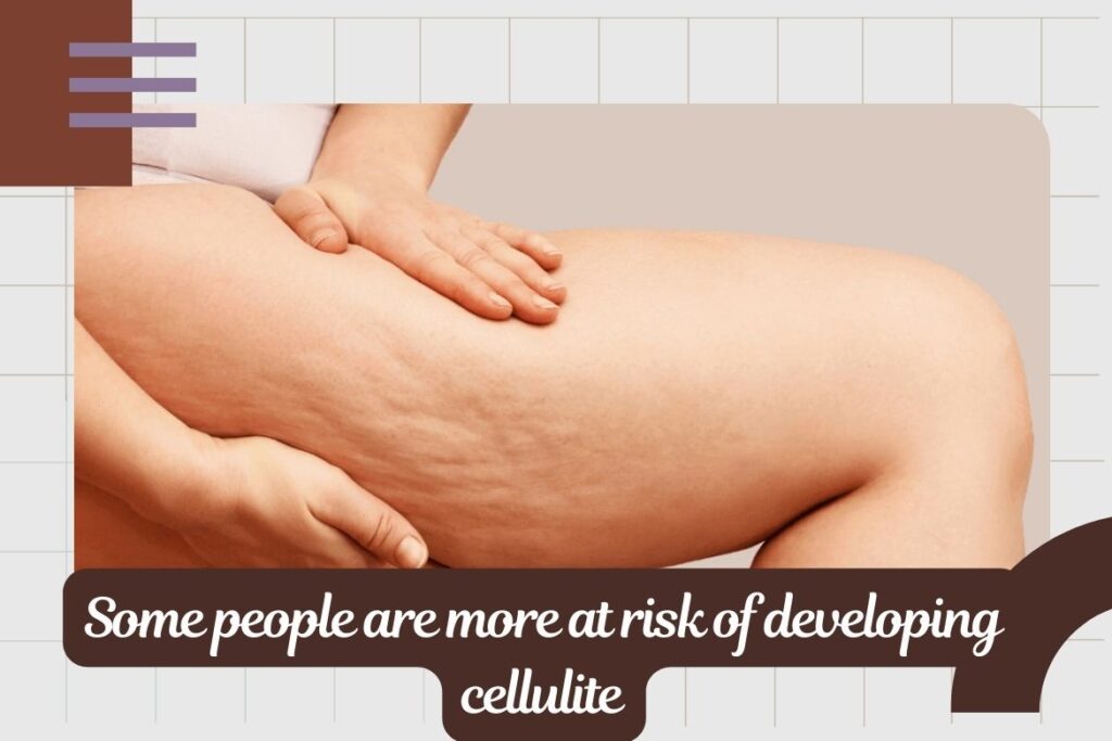 Some people are more at risk of developing cellulite